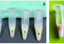 SES-DF precisa de solução para falta de banco de sêmen Por que o esperma pode ficar amarelado?