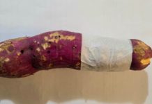 Nova “técnica” com micropore no pênis viraliza — médicos fazem alerta grave sobre os perigos