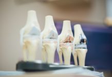 SES-DF firma três convênios com organização social que somam R$ 31,6 mi para ampliar diagnósticos e reduzir filas no DF