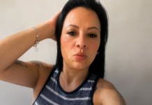 Mulher morre após ter 50% do intestino perfurado durante colonoscopia