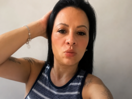 Mulher morre após ter 50% do intestino perfurado durante colonoscopia